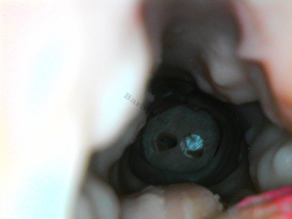 WM 149 head Barbydoll endoscope (11).jpg