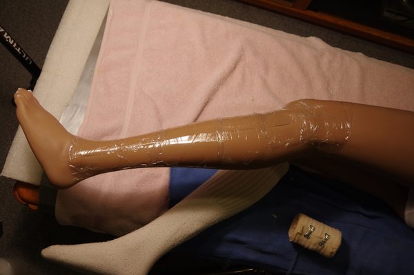 Lila Knee Repair (46).JPG