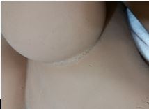 Breast.JPG