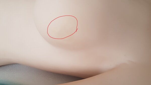 Left breast has a rough spot and a weird fabric mark 1