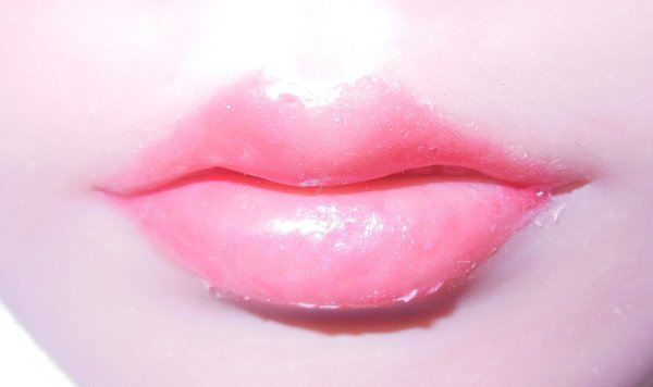 Lips after drying and cleaning up