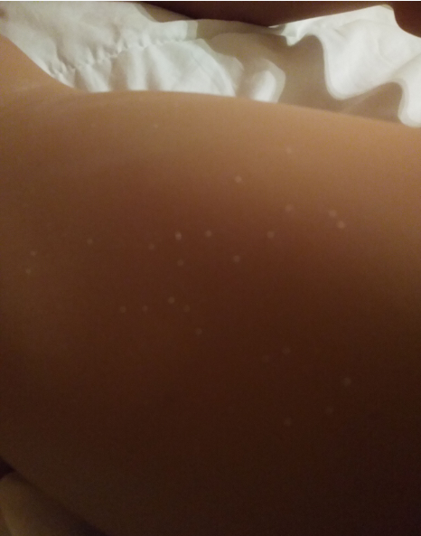 white dots left leg.png